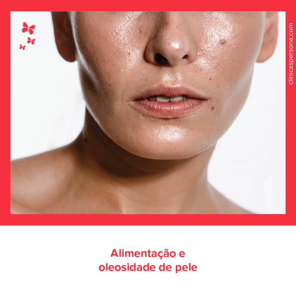 Clinicas Persona -- Oleosidade da pele