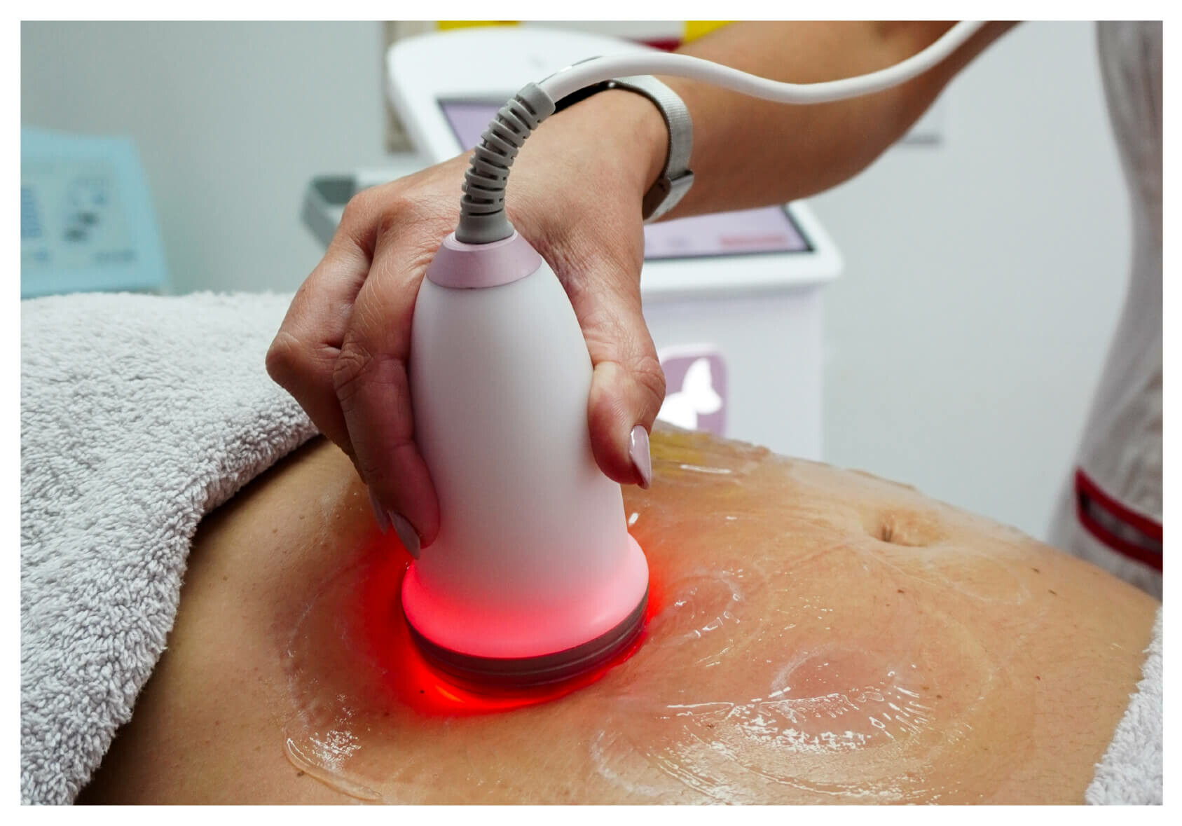 Grande plano de uma pessoa a receber um tratamento corporal não invasivo utilizando um dispositivo portátil de cavitação por ultra-sons que emite luz vermelha, aplicado no abdómen, com gel espalhado na pele. HimFU.