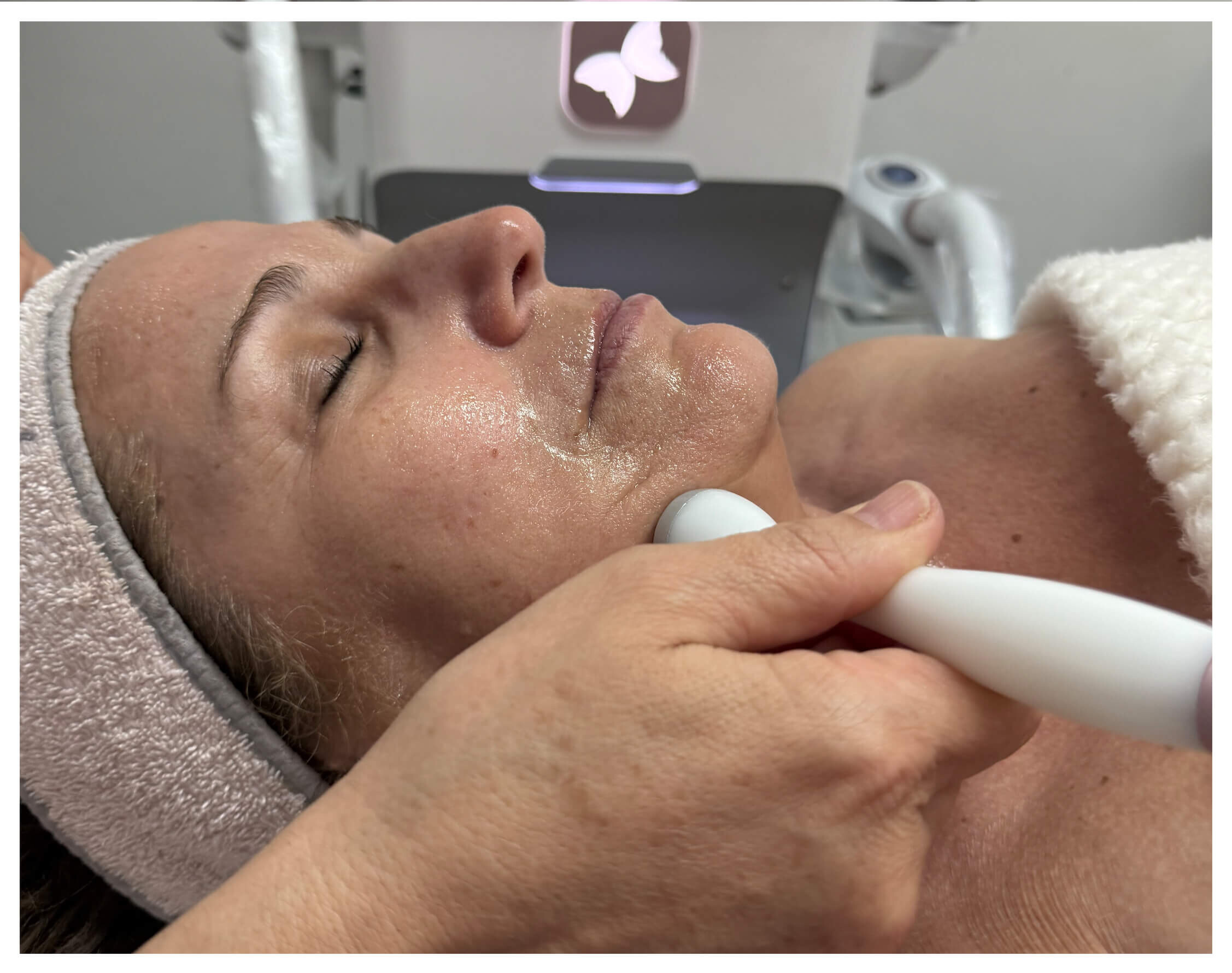 Uma mulher com uma fita para a cabeça deita-se numa cama de tratamento com os olhos fechados, enquanto uma pessoa utiliza um dispositivo portátil na linha do maxilar para um tratamento facial ou de pele.