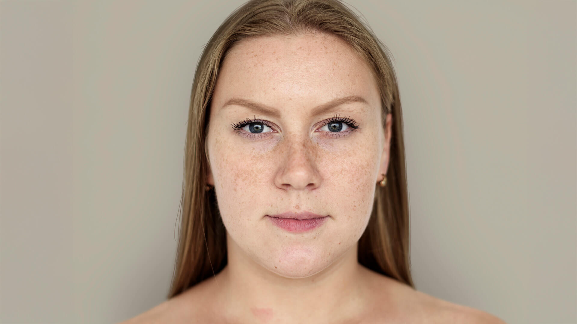Cuidados com a pele no verão: como prevenir manchas e manter a juventude