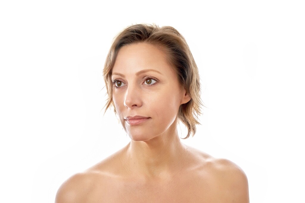 Clareamento do melasma nas Clínicas Persona