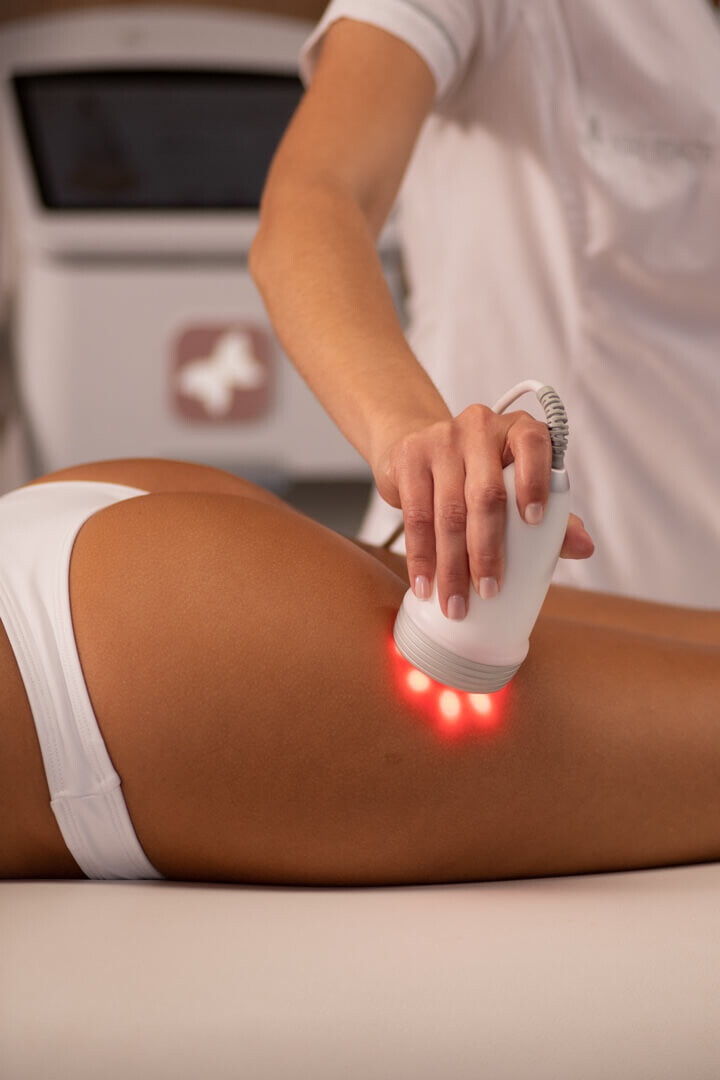 HimFU tem eficácia comprovada em milhares de tratamentos realizados de lipoaspiração não-invasiva.