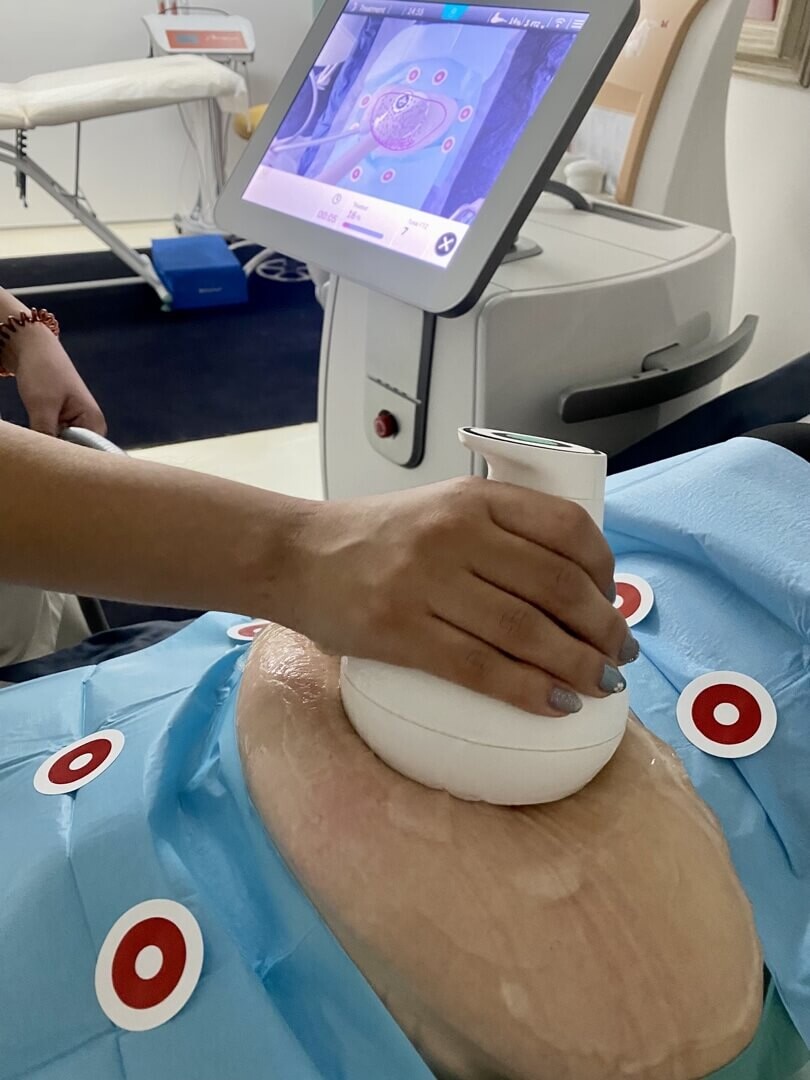 Lipoaspiração não invasiva em Lisboa ou lipoaspiração não invasiva no Porto com Pershape Power.