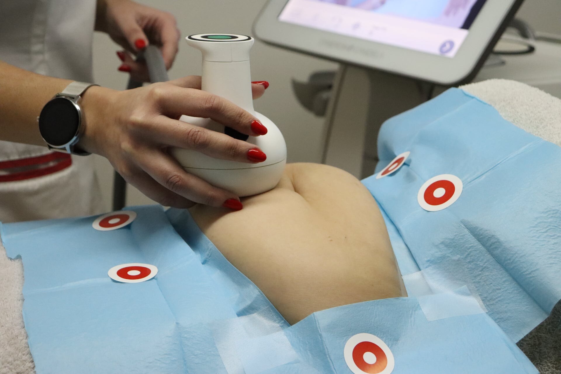 A lipoaspiração não-invasiva elimina gordura localizada sem cirurgia, sem cortes, sem tempo de recuperação. Para quem quer resultados reais sem os riscos de um bloco operatório.