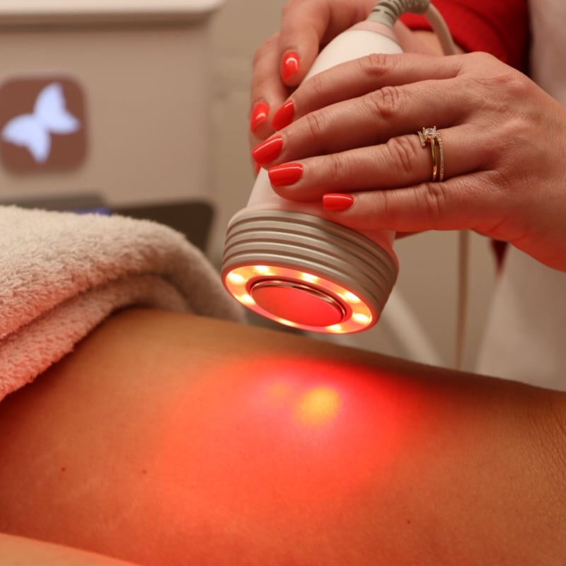 HimFu Tecnologia de ultrassom multifocal