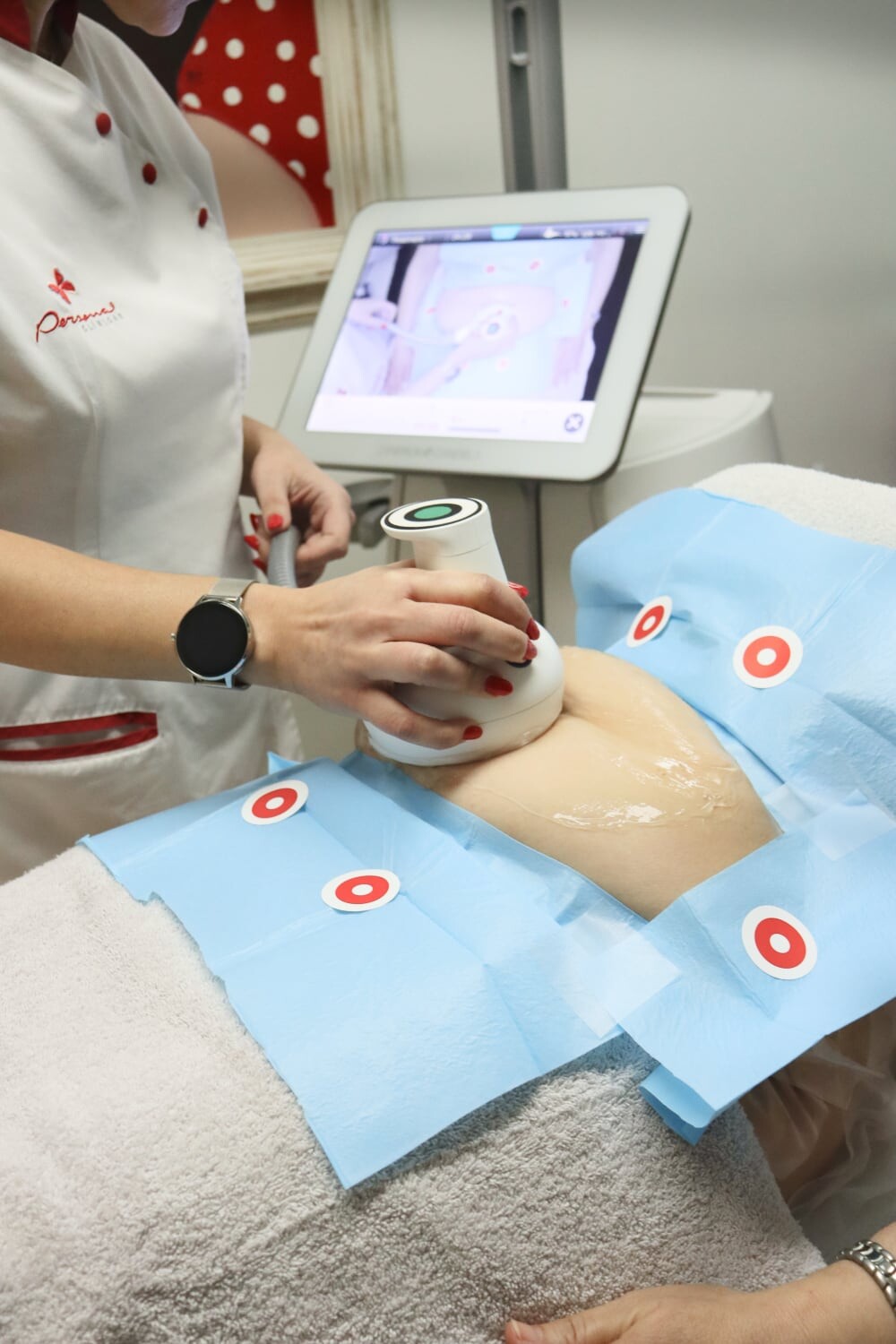 lipoaspiração não invasiva nas Clínicas Persona.