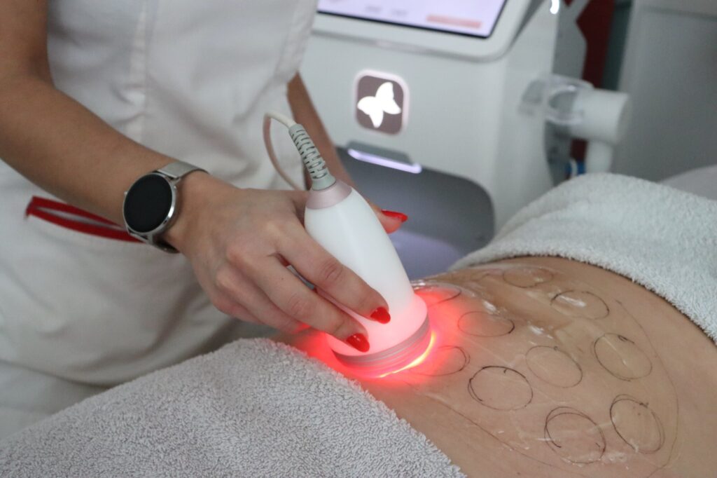 Tratamento HimFU em curso como um ultrasom multifocal.