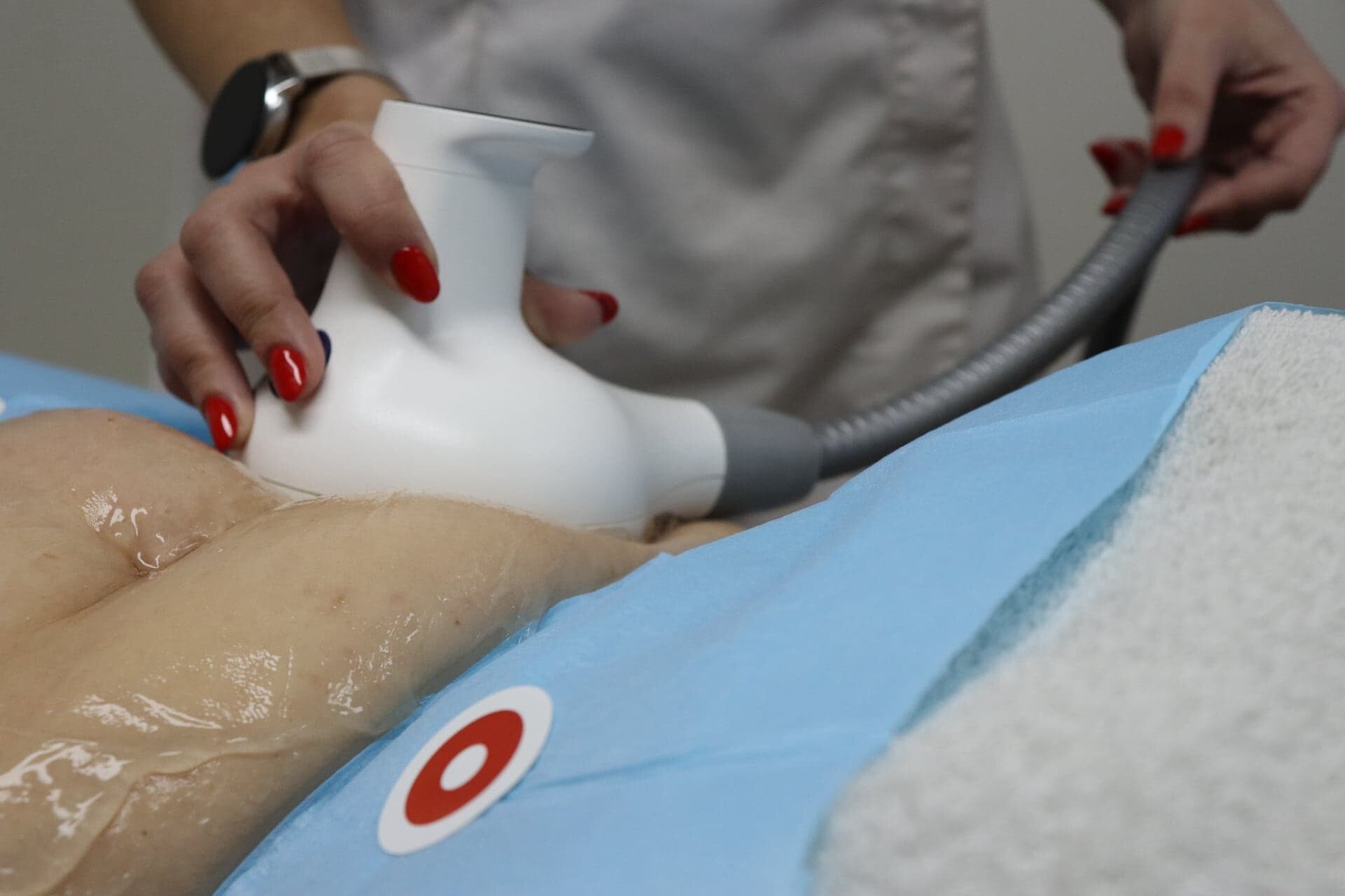 Lipoaspiração não-invasiva é um dos métodos para resolver a gordura abdominal.
