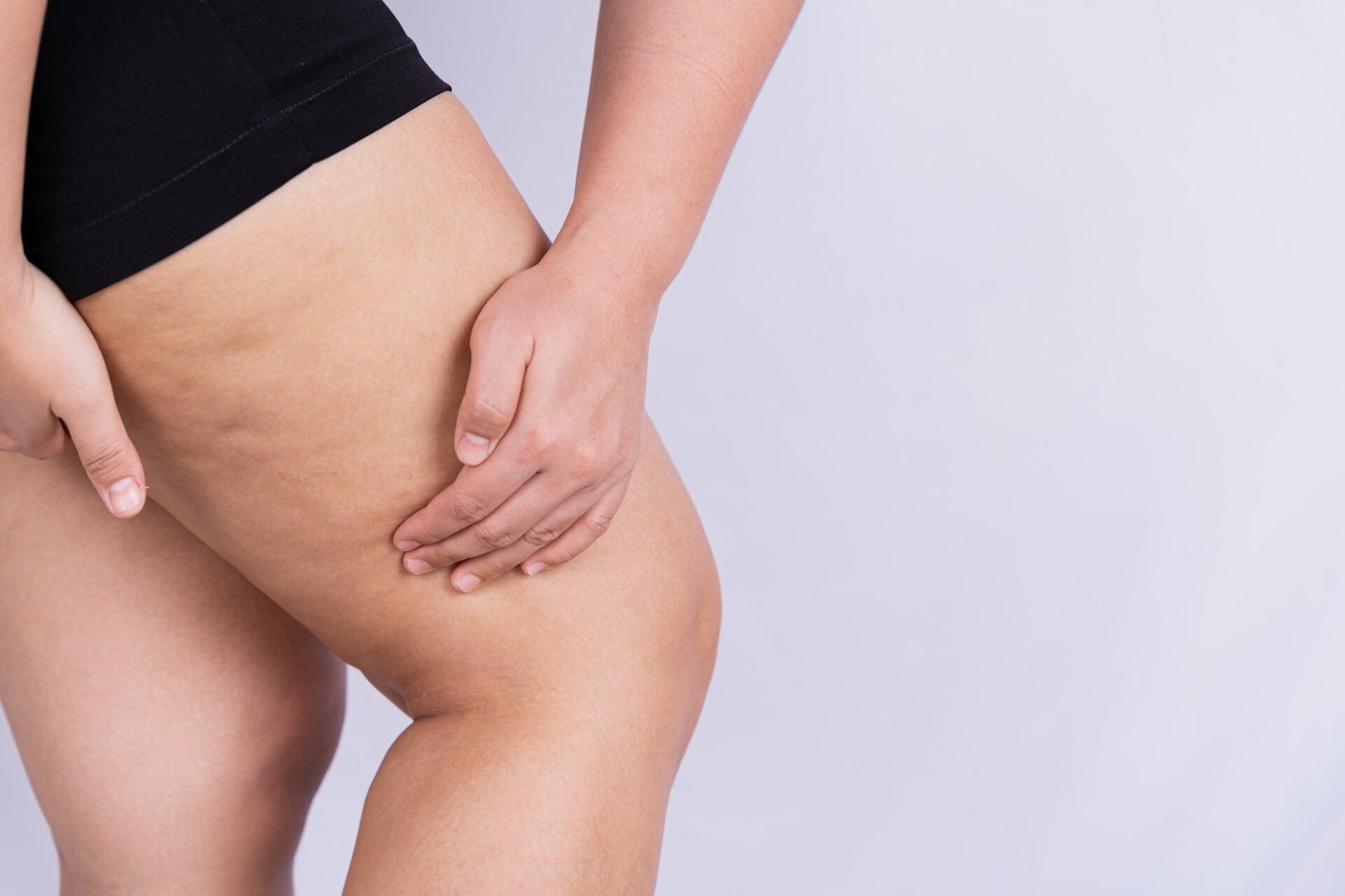 Gordura nas coxas e flancos: o que a tecnologia e a nutrição podem fazer que a dieta sozinha não consegue