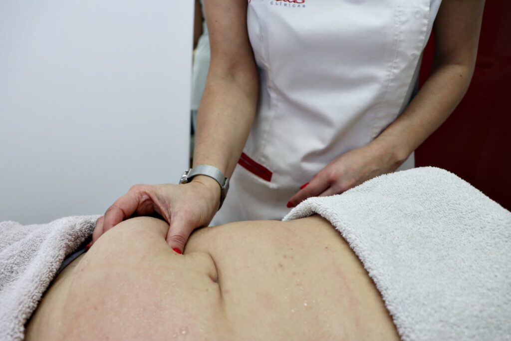 Pregas de gordura abdominal.